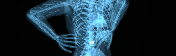 X-ray